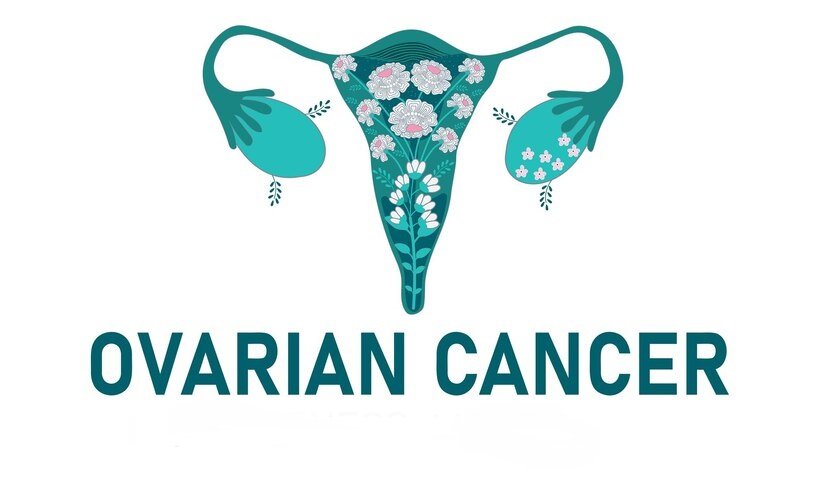 Ovarian Cancer