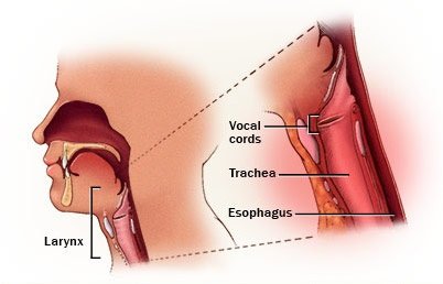 Best Larynx Cancer Treatment in Shalimar Bagh